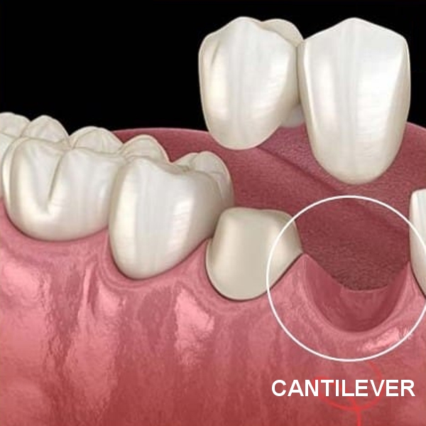 Odontología restauradora