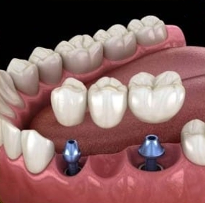 Odontología restauradora