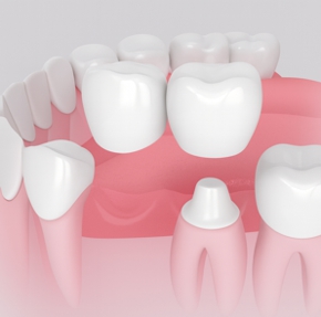 Odontología restauradora