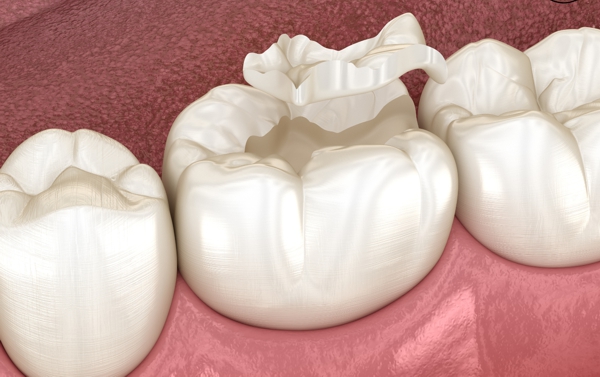 Odontología restauradora